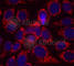 ERBB2 antibody, AP0152, ABclonal Technology, Immunofluorescence image 