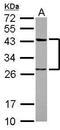 Twinfilin Actin Binding Protein 1 antibody, GTX117546, GeneTex, Western Blot image 