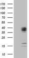 Chromosome 21 Open Reading Frame 62 antibody, LS-C791802, Lifespan Biosciences, Western Blot image 