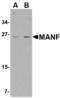 ARP antibody, LS-B2688, Lifespan Biosciences, Western Blot image 