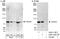 THO Complex 5 antibody, A302-120A, Bethyl Labs, Immunoprecipitation image 