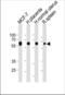 Histone Deacetylase 1 antibody, TA324515, Origene, Western Blot image 