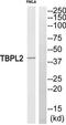 TATA box-binding protein-like protein 2 antibody, TA316397, Origene, Western Blot image 