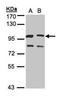 Guanine nucleotide-binding protein G(s) subunit alpha isoforms XLas antibody, orb74127, Biorbyt, Western Blot image 