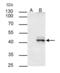 HLA class I histocompatibility antigen, A-1 alpha chain antibody, GTX114080, GeneTex, Immunoprecipitation image 