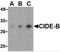 Cell Death Inducing DFFA Like Effector B antibody, 2321, ProSci Inc, Western Blot image 