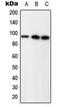 Progesterone Receptor antibody, MBS820446, MyBioSource, Western Blot image 