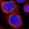 Coiled-Coil Domain Containing 155 antibody, NBP1-81993, Novus Biologicals, Immunofluorescence image 