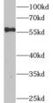 Corticotropin Releasing Hormone Receptor 2 antibody, FNab01975, FineTest, Western Blot image 