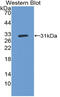 Cytochrome P450 Family 27 Subfamily B Member 1 antibody, MBS2027881, MyBioSource, Western Blot image 