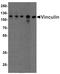 Vinculin antibody, TA355000, Origene, Western Blot image 