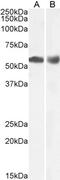 Histone Deacetylase 1 antibody, LS-C154779, Lifespan Biosciences, Western Blot image 
