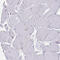 SEC61 Translocon Beta Subunit antibody, HPA049407, Atlas Antibodies, Immunohistochemistry paraffin image 