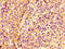 LIM and senescent cell antigen-like-containing domain protein 1 antibody, CSB-PA012955EA01HU, Cusabio, Immunohistochemistry paraffin image 