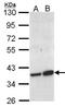 Aminocarboxymuconate Semialdehyde Decarboxylase antibody, LS-C185833, Lifespan Biosciences, Western Blot image 