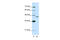 Zinc Finger Protein 396 antibody, 29-145, ProSci, Western Blot image 