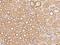 Netrin receptor UNC5D antibody, 205493-T08, Sino Biological, Immunohistochemistry paraffin image 