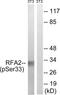 RPA32 antibody, LS-C199535, Lifespan Biosciences, Western Blot image 