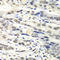 Nudix Hydrolase 1 antibody, STJ27427, St John
