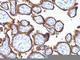 EGFR antibody, V2485IHC-7ML, NSJ Bioreagents, Immunohistochemistry paraffin image 