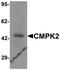 Cytidine/Uridine Monophosphate Kinase 2 antibody, 7063, ProSci, Western Blot image 