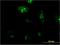 Ribosomal Protein L23a antibody, H00006147-M10, Novus Biologicals, Immunocytochemistry image 