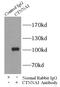 Catenin alpha-1 antibody, FNab00327, FineTest, Immunoprecipitation image 