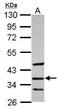 Secreted Frizzled Related Protein 5 antibody, GTX114747, GeneTex, Western Blot image 