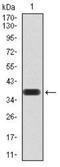 Peroxisome Proliferator Activated Receptor Alpha antibody, NBP2-52538, Novus Biologicals, Western Blot image 