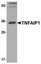 TNF Alpha Induced Protein 1 antibody, A06143, Boster Biological Technology, Western Blot image 