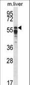 Protein Phosphatase 2 Regulatory Subunit B'Alpha antibody, LS-C162088, Lifespan Biosciences, Western Blot image 