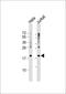 Ribosomal Protein S11 antibody, 64-041, ProSci, Western Blot image 