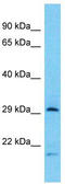 Tryptase Beta 2 (Gene/Pseudogene) antibody, TA330796, Origene, Western Blot image 