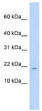 Leukocyte Associated Immunoglobulin Like Receptor 2 antibody, TA346322, Origene, Western Blot image 