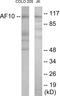 MLLT10 Histone Lysine Methyltransferase DOT1L Cofactor antibody, EKC1752, Boster Biological Technology, Western Blot image 