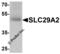 Equilibrative nucleoside transporter 2 antibody, 8127, ProSci Inc, Western Blot image 