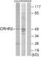 Corticotropin Releasing Hormone Receptor 2 antibody, LS-B9098, Lifespan Biosciences, Western Blot image 