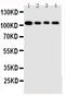 Hsp110 antibody, PA1608, Boster Biological Technology, Western Blot image 