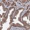 Centrosomal Protein 76 antibody, HPA039395, Atlas Antibodies, Immunohistochemistry paraffin image 