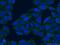 Lactate Dehydrogenase A antibody, 66287-1-Ig, Proteintech Group, Immunofluorescence image 