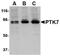 Protein Tyrosine Kinase 7 (Inactive) antibody, AP05710PU-N, Origene, Western Blot image 