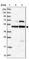 Nucleoporin 58 antibody, PA5-58753, Invitrogen Antibodies, Western Blot image 