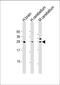 BTB/POZ domain-containing protein KCTD11 antibody, M10796, Boster Biological Technology, Western Blot image 