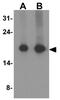 NECC1 antibody, GTX32152, GeneTex, Western Blot image 