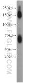 GLT-1 antibody, 22515-1-AP, Proteintech Group, Western Blot image 
