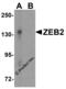 Zinc Finger E-Box Binding Homeobox 2 antibody, 5827, ProSci Inc, Western Blot image 