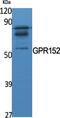 G Protein-Coupled Receptor 152 antibody, PA5-50975, Invitrogen Antibodies, Western Blot image 