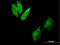 Cytoplasmic dynein 1 intermediate chain 2 antibody, H00001781-B01P, Novus Biologicals, Immunocytochemistry image 