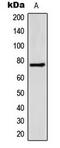 Bile acyl-CoA synthetase antibody, LS-C354152, Lifespan Biosciences, Western Blot image 