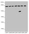 Long-chain-fatty-acid--CoA ligase 6 antibody, LS-C675355, Lifespan Biosciences, Western Blot image 